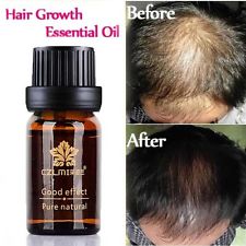 Natural Hair Loss Treatment Herbal Essence Men Women Hair Fast Growth Herbs Oil